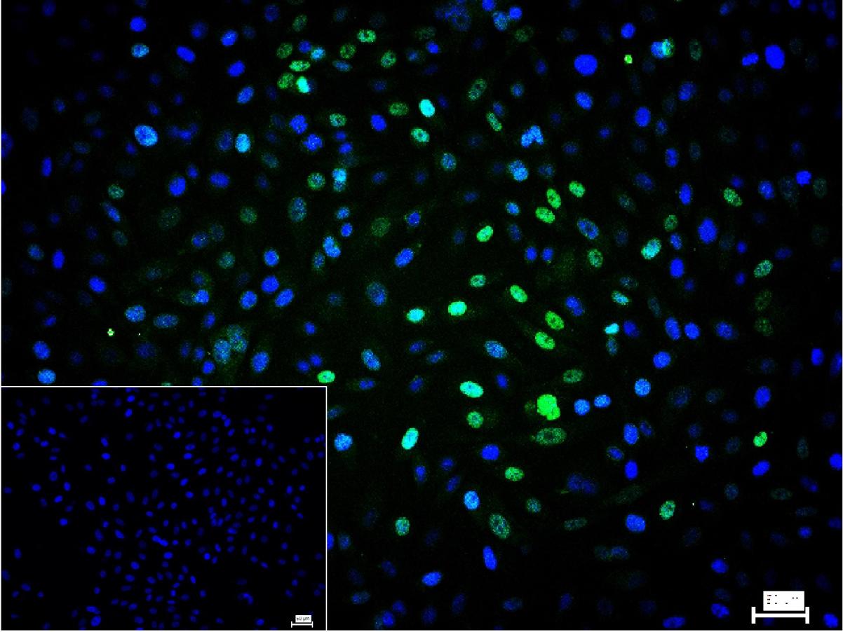 核心结合因子α1重组兔单抗