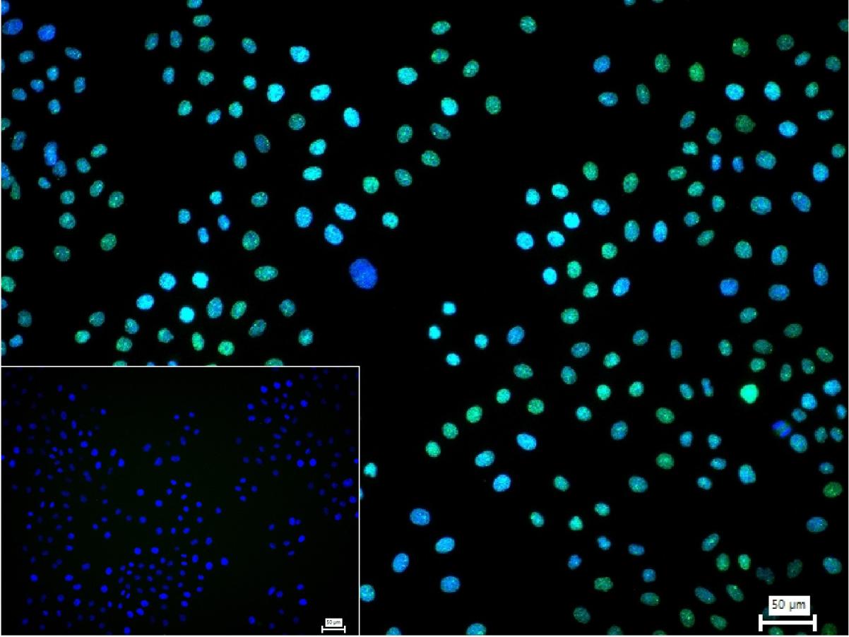 核糖核酸结合蛋白1重组兔单抗-bsm-60550R