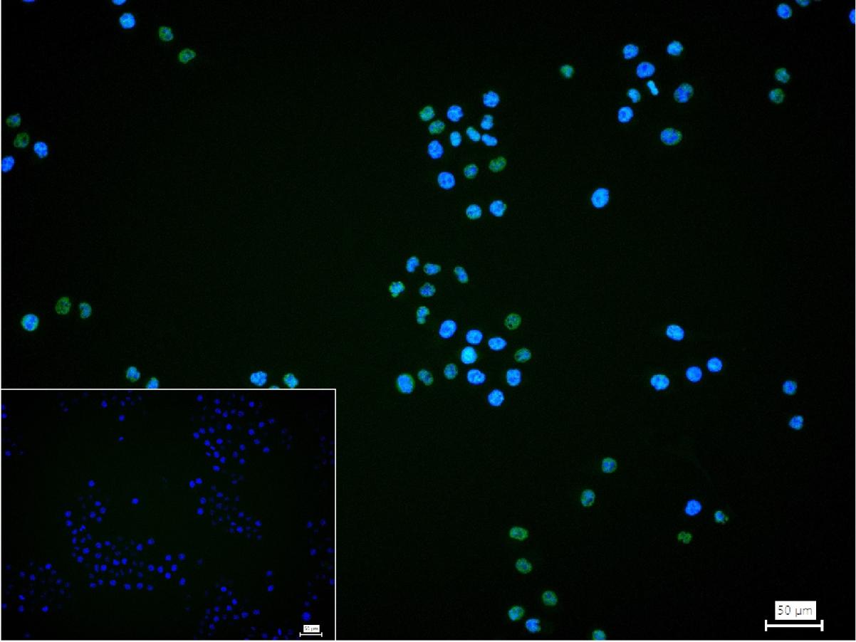 磷酸化信号转导和转录激活因子3重组兔单抗
