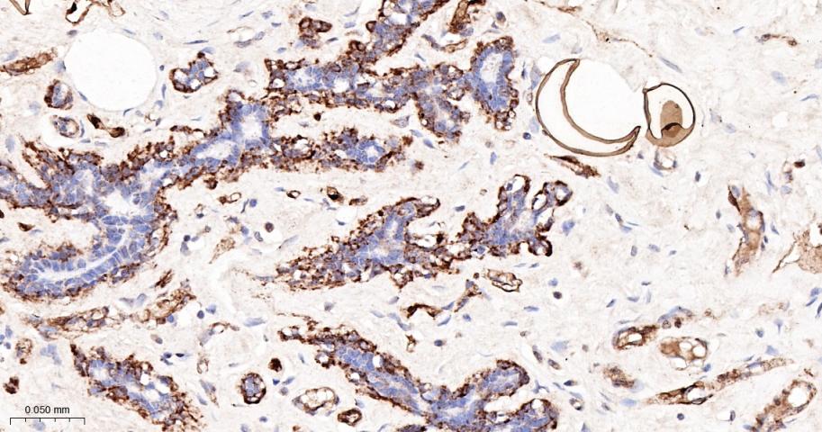 脂肪细胞型脂肪酸结合蛋白4重组兔单抗