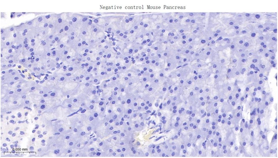 胶原蛋白17重组兔单抗