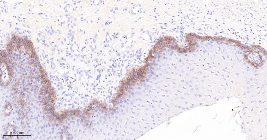 胶原蛋白17重组兔单抗