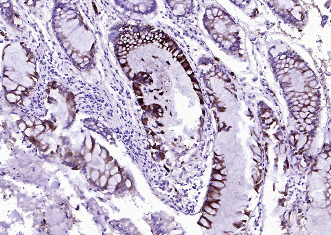 Lipocalin 2/NGAL Rabbit pAb (一抗) - IHC-P,IHC-F,IF,ELISA | Bioss