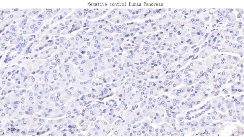 胶原蛋白17重组兔单抗