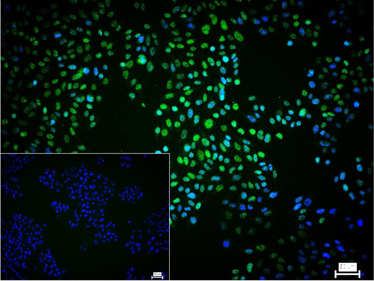 B Raf重组兔单抗