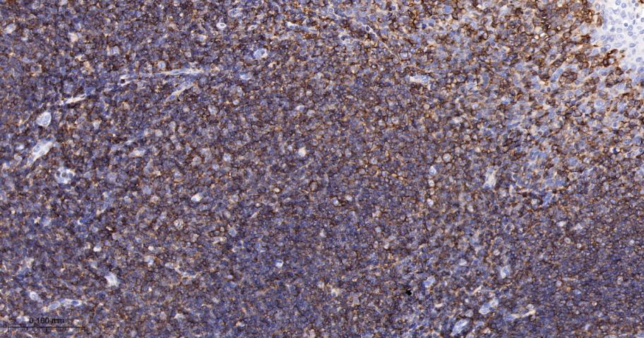 CD44单克隆抗体-bsm-51065M