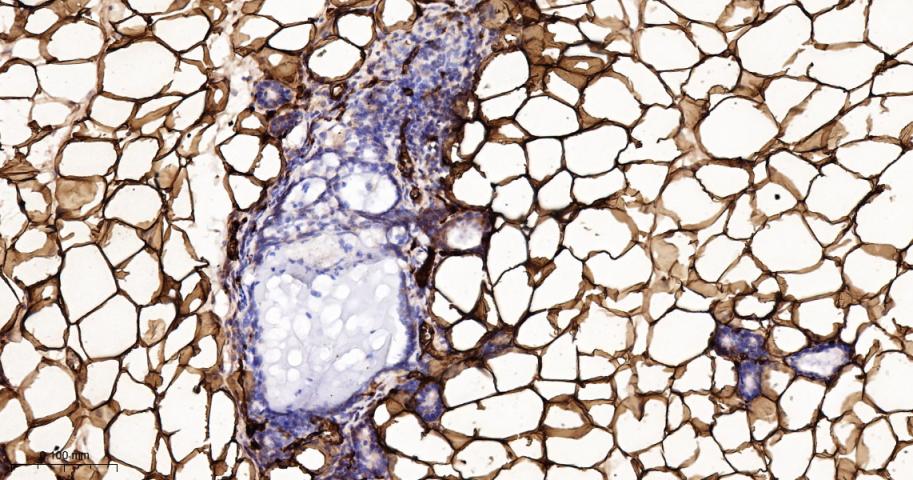 脂肪细胞型脂肪酸结合蛋白4重组兔单抗