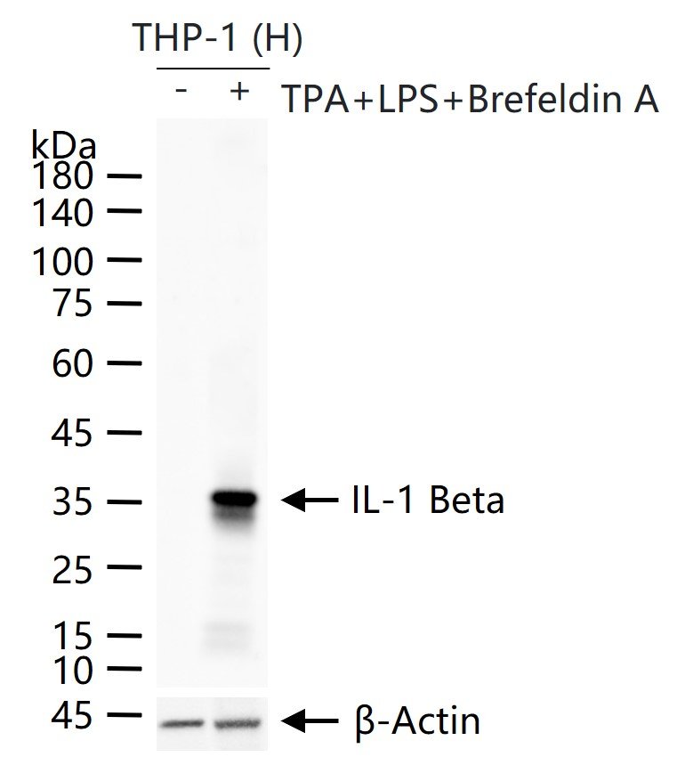 白介素1β/IL-1β抗体-bs-0812R