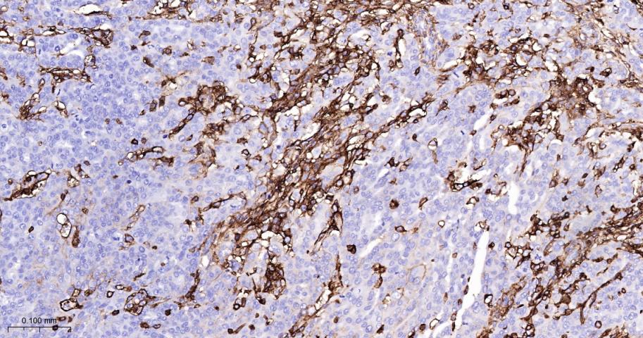 CD44单克隆抗体-bsm-51065M