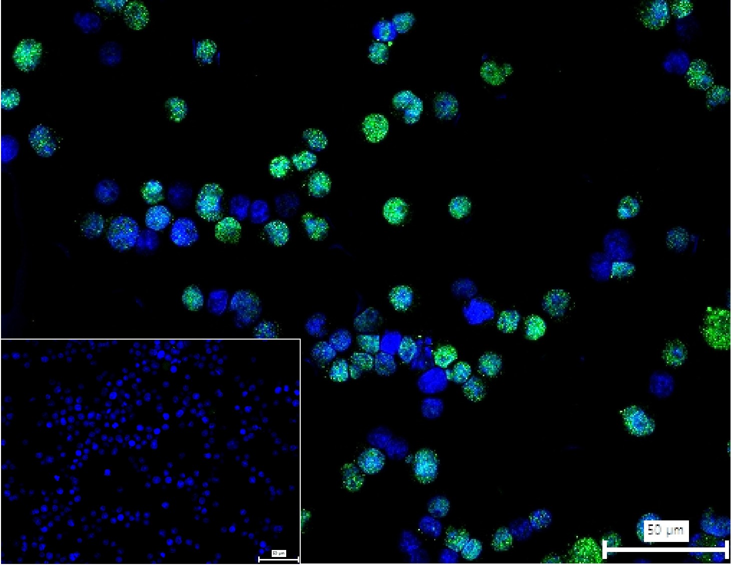 癌基因ERG重组兔单抗