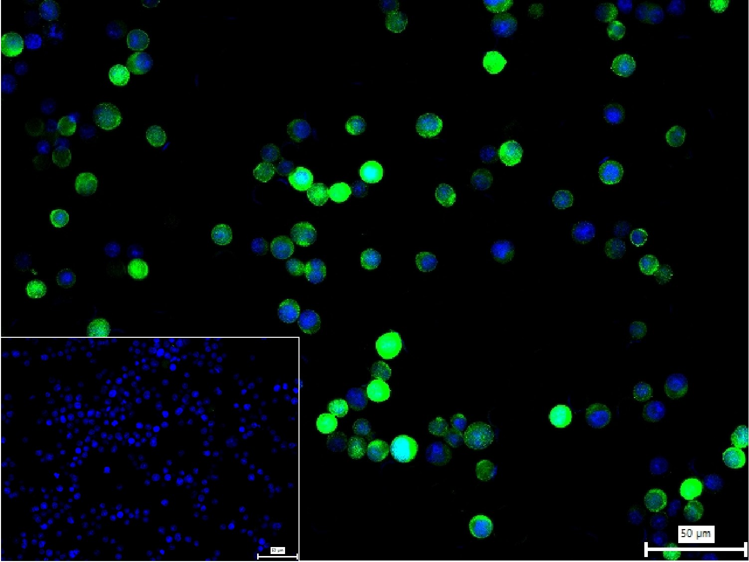 谷胱甘肽硫转移酶pi重组兔单抗