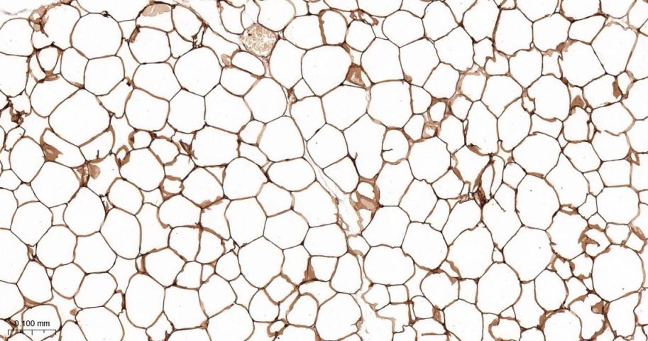 脂肪细胞型脂肪酸结合蛋白4重组兔单抗