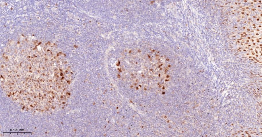 活化蛋白激酶B重组兔单抗