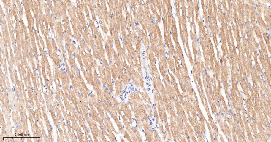 磷酸化原癌基因RAF1重组兔单抗