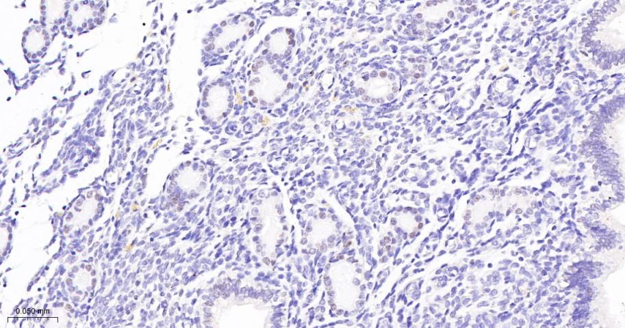 活化蛋白激酶B重组兔单抗