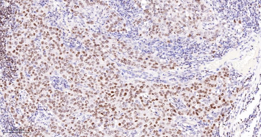 多腺苷二磷酸多聚酶/多聚ADP-核糖聚合酶1重组兔单抗