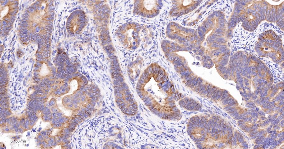 CD276重组兔单抗