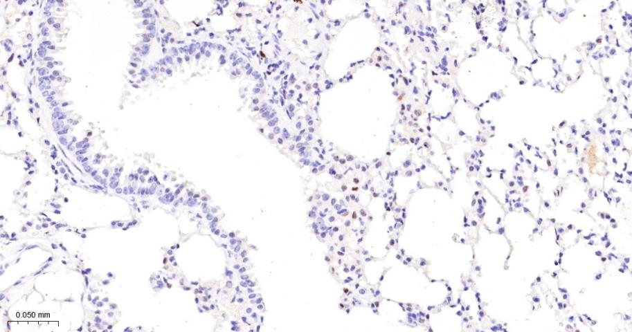 活化蛋白激酶B重组兔单抗