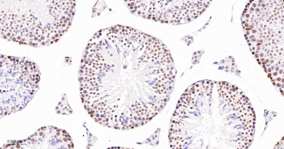 多腺苷二磷酸多聚酶/多聚ADP-核糖聚合酶1重组兔单抗