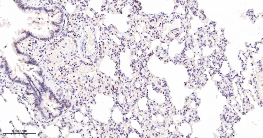 多腺苷二磷酸多聚酶/多聚ADP-核糖聚合酶1重组兔单抗