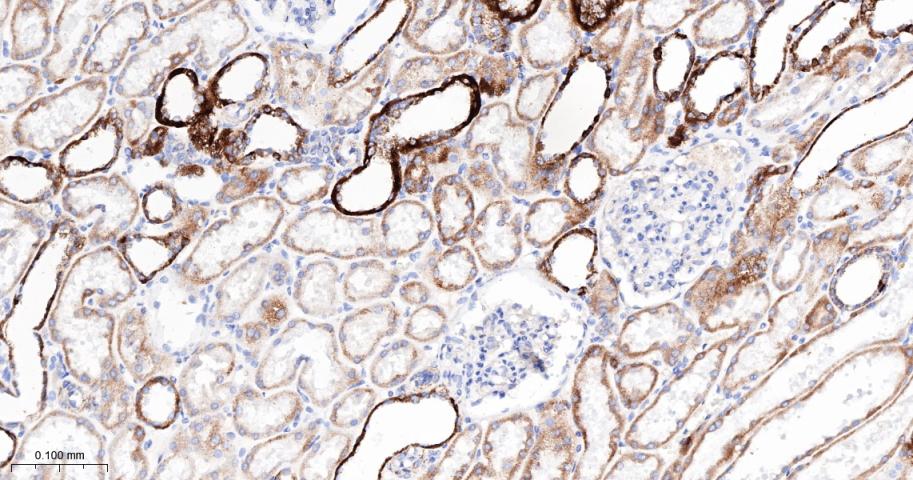 丙酮酸脱氢酶激酶亚型2重组兔单抗
