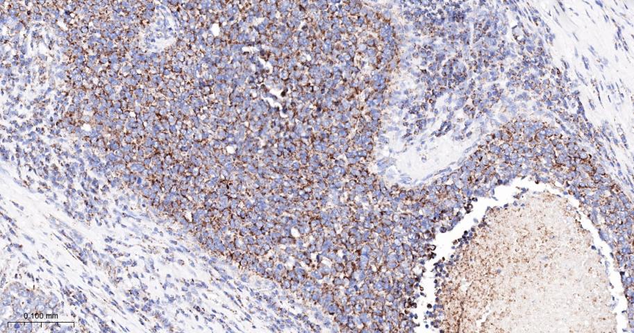 丙酮酸脱氢酶激酶亚型2重组兔单抗