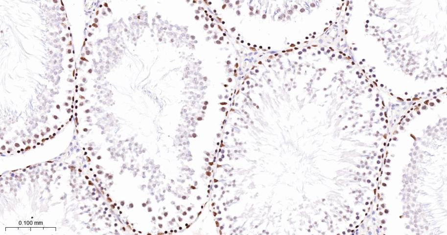 多腺苷二磷酸多聚酶/多聚ADP-核糖聚合酶1重组兔单抗