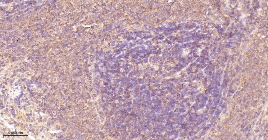 磷酸化原癌基因RAF1重组兔单抗