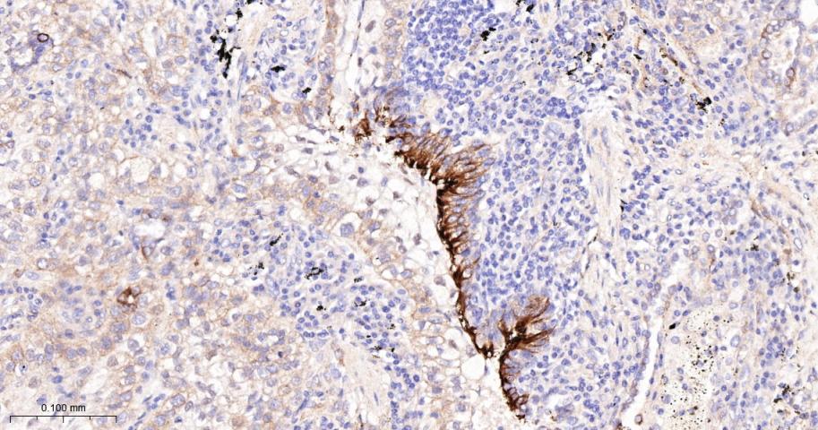 CD276重组兔单抗