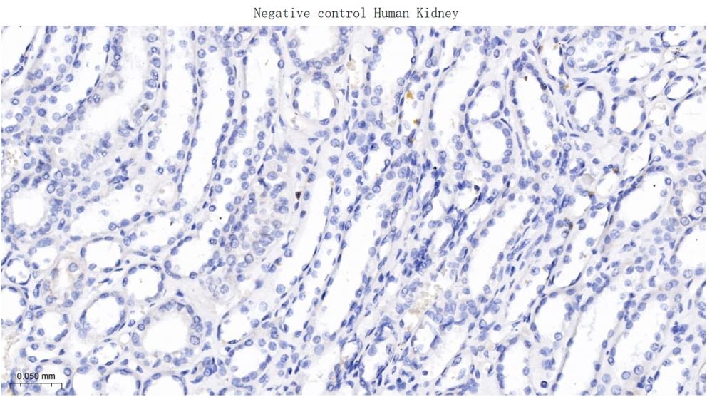人绒毛膜促性腺激素β重组兔单抗