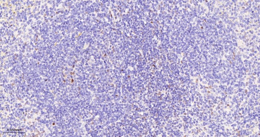 活化蛋白激酶B重组兔单抗