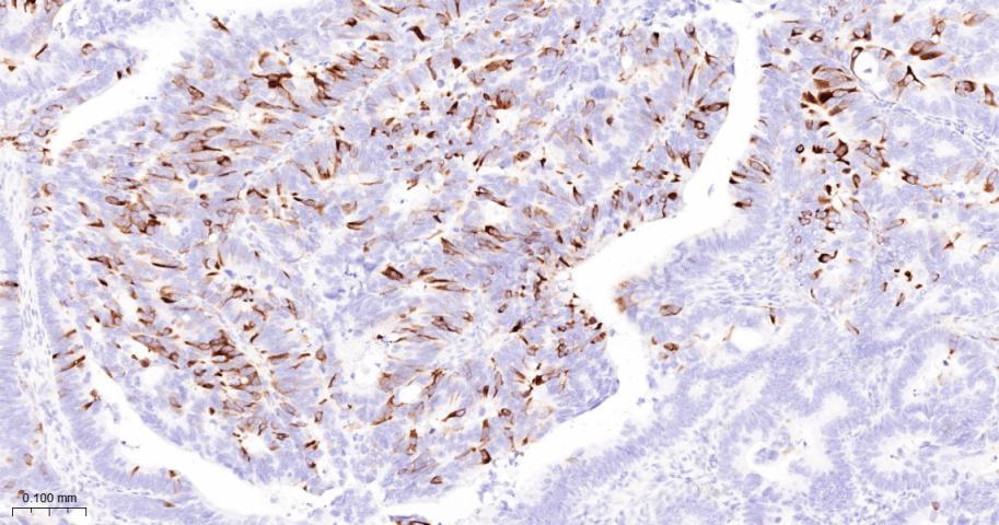 周期素B1重组兔单抗