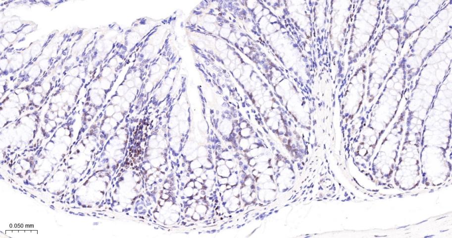 多腺苷二磷酸多聚酶/多聚ADP-核糖聚合酶1重组兔单抗