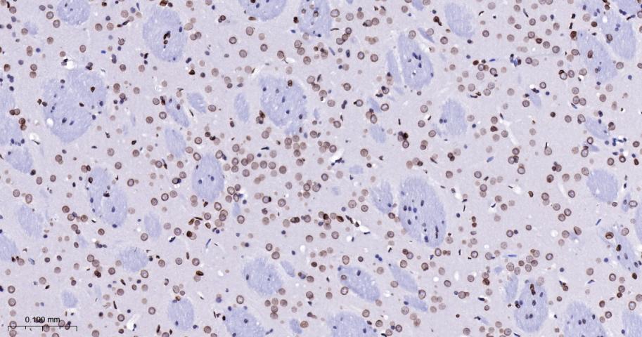 核纤层蛋白B(核内参)重组兔单抗