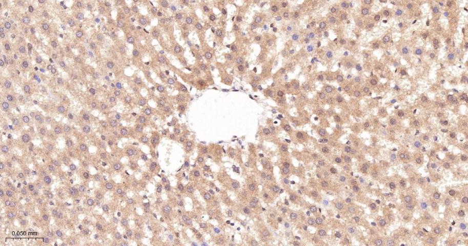 磷酸化原癌基因RAF1重组兔单抗