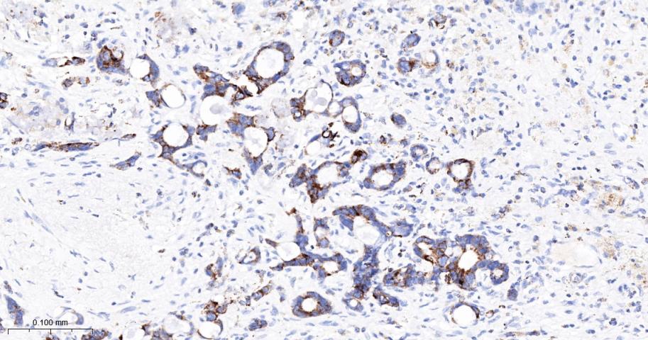 丙酮酸脱氢酶激酶亚型2重组兔单抗