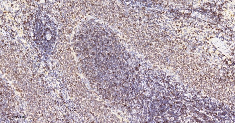 核纤层蛋白B(核内参)重组兔单抗