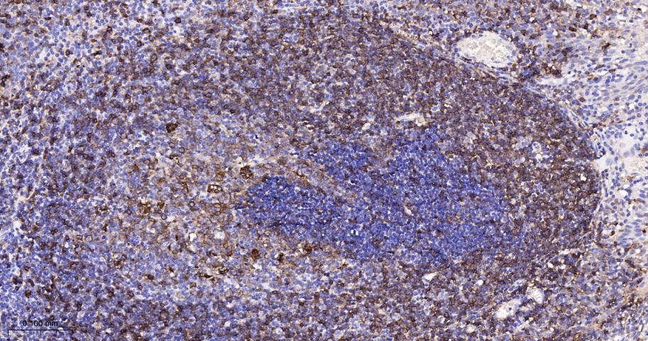 HLA-DR重组兔单抗