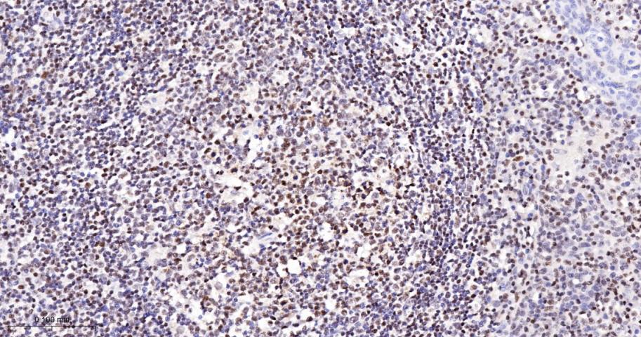 多腺苷二磷酸多聚酶/多聚ADP-核糖聚合酶1重组兔单抗