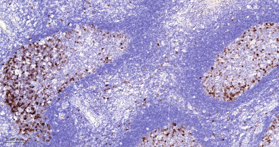 周期素B1重组兔单抗