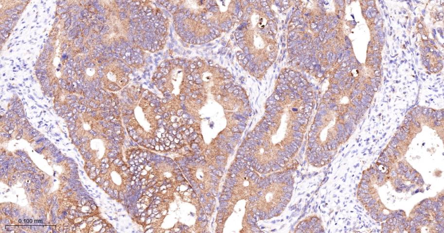 磷酸化原癌基因RAF1重组兔单抗