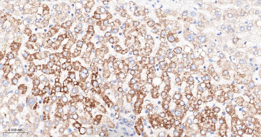 丙酮酸脱氢酶激酶亚型2重组兔单抗