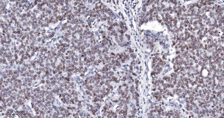 核纤层蛋白B(核内参)重组兔单抗