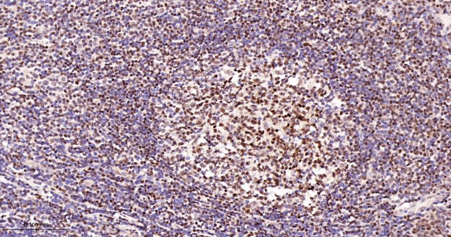 多腺苷二磷酸多聚酶/多聚ADP-核糖聚合酶1重组兔单抗