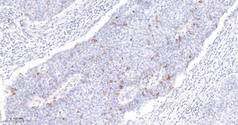 周期素B1重组兔单抗