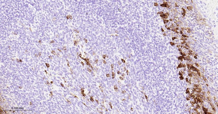 多配体蛋白聚糖1（CD138）重组兔单抗