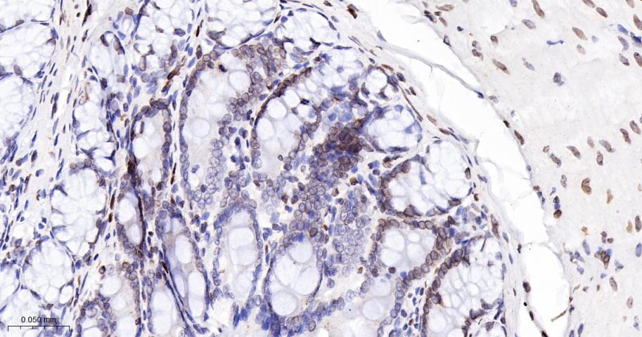 核纤层蛋白B(核内参)重组兔单抗