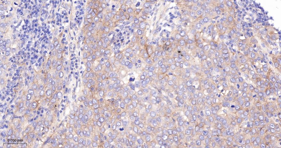 CD276重组兔单抗