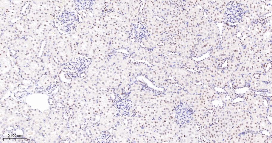 多腺苷二磷酸多聚酶/多聚ADP-核糖聚合酶1重组兔单抗