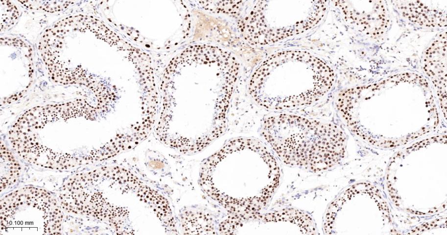 多腺苷二磷酸多聚酶/多聚ADP-核糖聚合酶1重组兔单抗